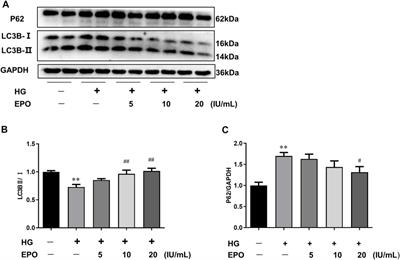 Erythropoietin Mitigates Diabetic Nephropathy by Restoring PINK1/Parkin-Mediated Mitophagy